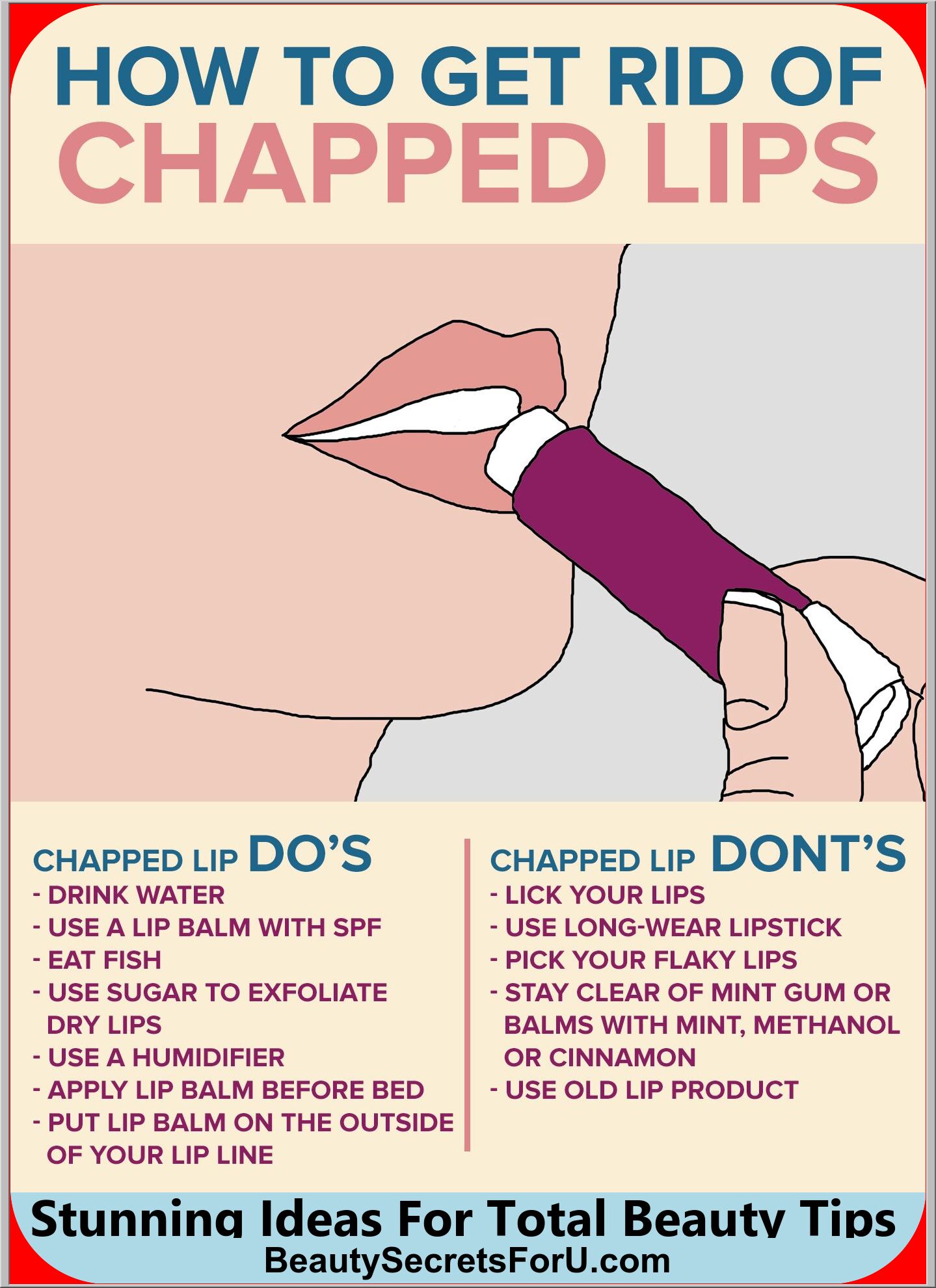 Chapped lips do’s and don’ts